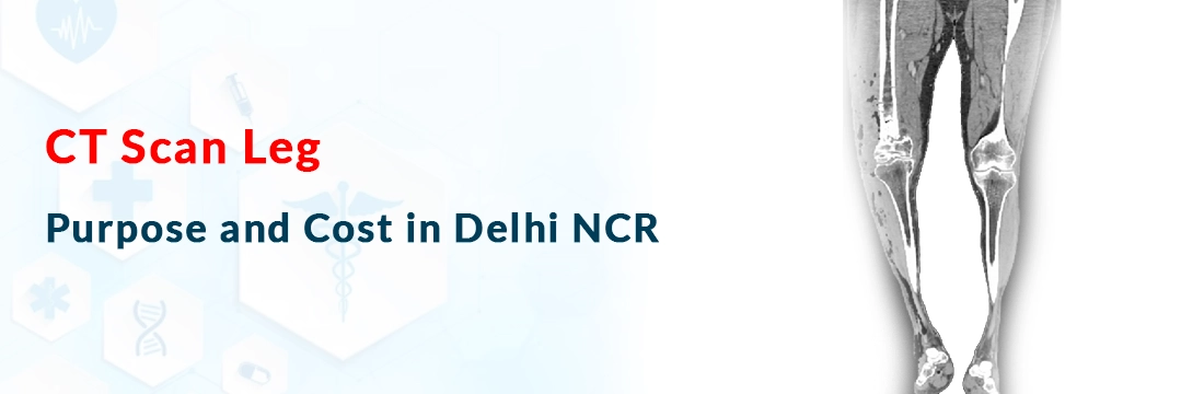 CT Scan Leg: Purpose and Cost in Delhi NCR